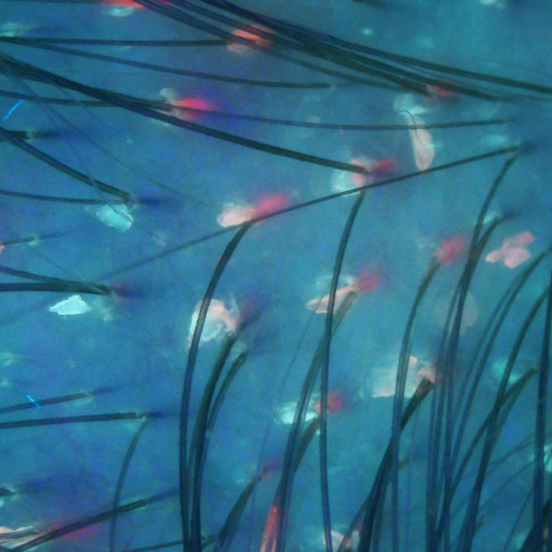 K Scan Image 2